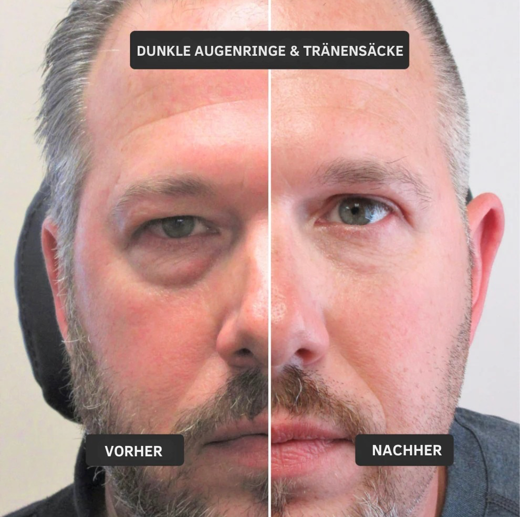 VollKraft+ Augen-Repair Stick